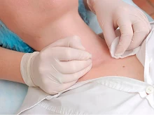 Chirurgiczne  usuwanie zmian  w Krakowie - Cracovia Clinic
