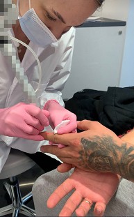 Laserowa epilacja dla mężczyzn  w Krakowie - Cracovia Clinic