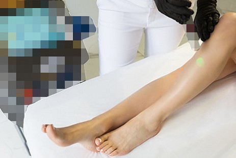 Laserowa depilacja nóg  w Krakowie - Cracovia Clinic