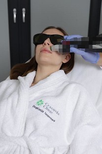 Depilacja laserowa wąsika i brody  w Krakowie - Cracovia Clinic