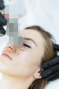 Laserowe leczenie trądziku  w Krakowie - Cracovia Clinic